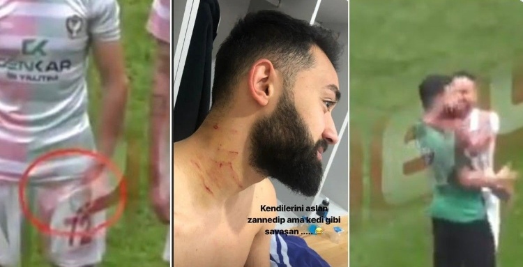 😨你也是修理工？土耳其乙级联赛球员持刀上场，对手颈部被划伤